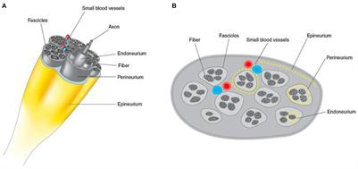 Silent peripheral neuropathy determined by high-resolution ultrasound among contacts of patients with Hansen's disease